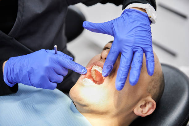Best Emergency Gum Pain Relief  in Spring Valley, CA
